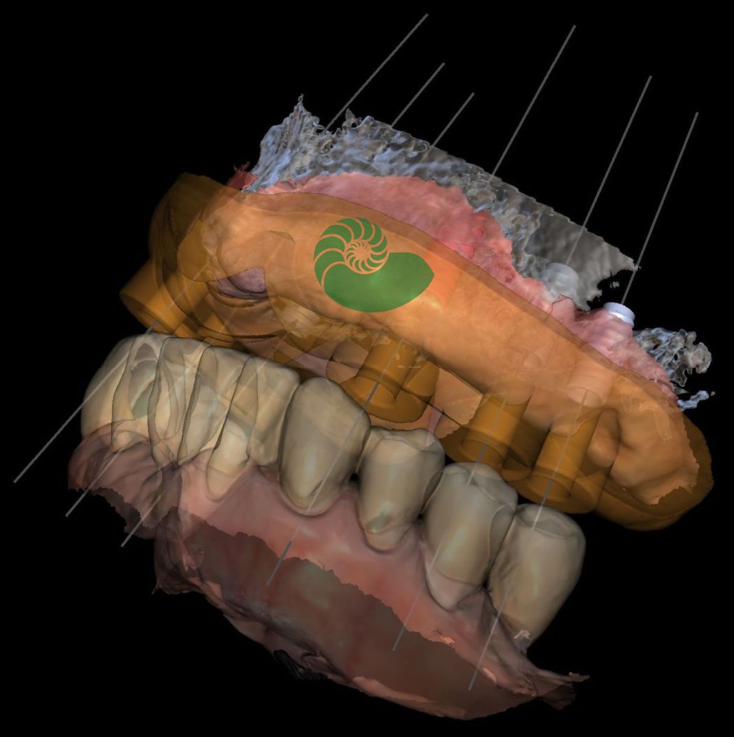 3D-Planungsmodell